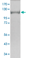 SDS-PAGE Result